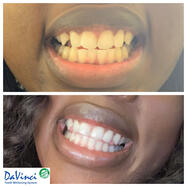 ✿˃̣̣̥‸˂̣̣̥᷅ ) &amp; 彡✿╹◡╹)