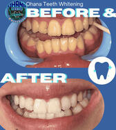 ( ͡° ͜ʖ ͡°) 🏳️🤍