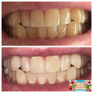 ( ͡° ͜ʖ ͡°)_/¯෴🤍෴