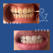 ( ͡⚆ ͜ʖ ͡⚆) ✨🦷