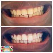 (人◕‿◕) 🤳🏿